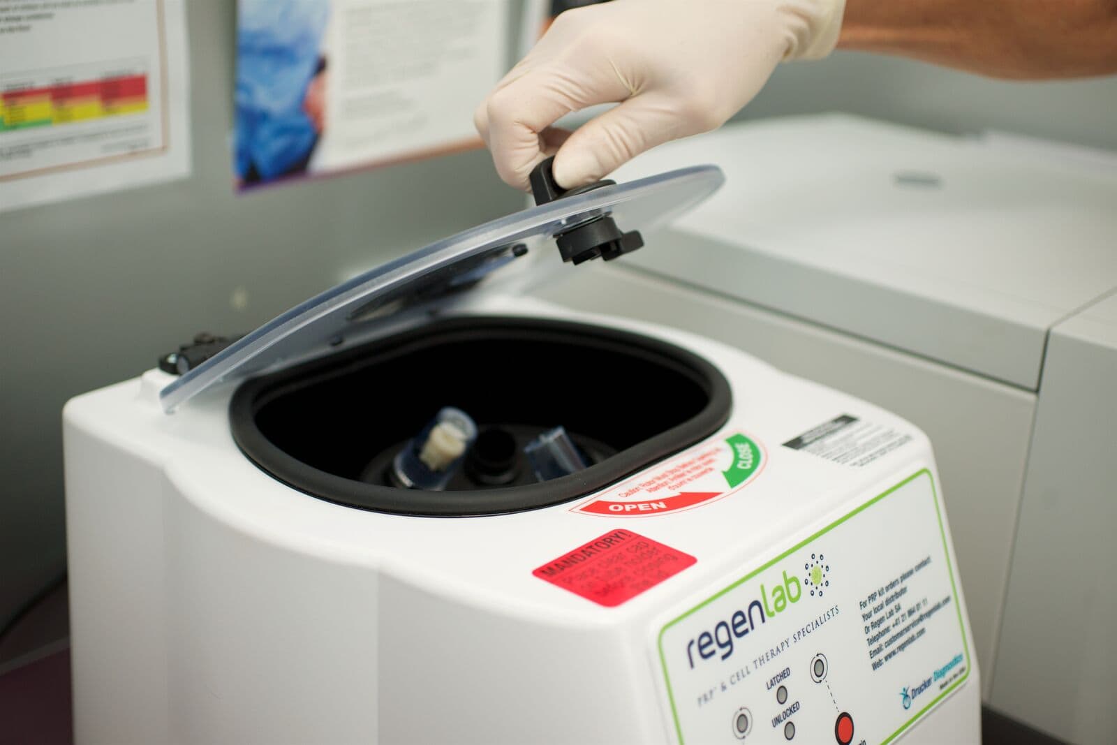 Carla Agostino – PRP – Option 2